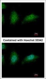 ZNHIT2 Polyclonal Antibody
