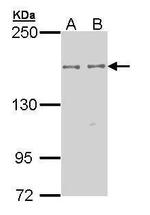 EPB41L2 Polyclonal Antibody