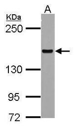 HDLBP Antibody in Western Blot (WB)