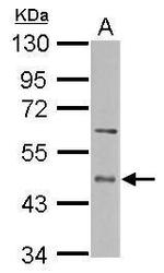 ENTPD5 Polyclonal Antibody