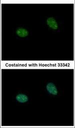 PRICKLE3 Polyclonal Antibody