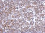 Hemopexin Polyclonal Antibody