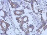 Cytokeratin 31 Antibody in Immunohistochemistry (Paraffin) (IHC (P))