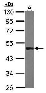Cytokeratin 31 Antibody in Western Blot (WB)