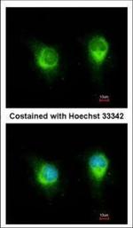KTN1 Polyclonal Antibody