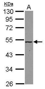 MAT2A Polyclonal Antibody