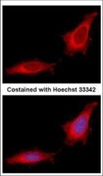 GANC Polyclonal Antibody