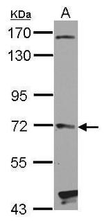 HHIP Antibody in Western Blot (WB)