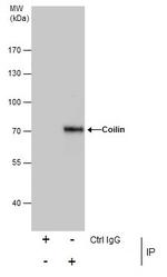 Coilin Antibody in Immunoprecipitation (IP)