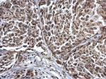 Coilin Antibody in Immunohistochemistry (Paraffin) (IHC (P))