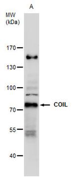 Coilin Antibody in Western Blot (WB)