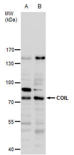 Coilin Antibody in Western Blot (WB)