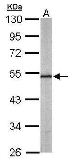 Septin-11 Antibody in Western Blot (WB)