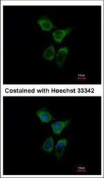 ERO1L Polyclonal Antibody