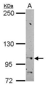 HSPA4 Antibody in Western Blot (WB)