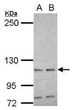HSPA4 Antibody in Western Blot (WB)