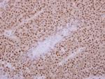 KIF3C Polyclonal Antibody