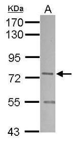 SNX1 Polyclonal Antibody