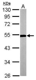 TUBA4A Antibody in Western Blot (WB)