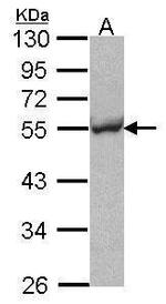 TUBA4A Antibody in Western Blot (WB)