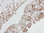 Cytokeratin 19 Antibody in Immunohistochemistry (Paraffin) (IHC (P))