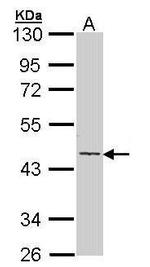 Cytokeratin 19 Antibody in Western Blot (WB)