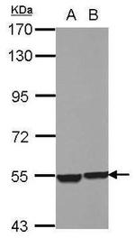 cathepsin A Antibody in Western Blot (WB)