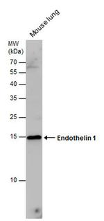 Endothelin 1 Antibody in Western Blot (WB)