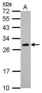 Endothelin 1 Antibody in Western Blot (WB)