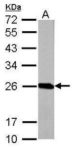 GSTP1 Antibody in Western Blot (WB)