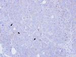 BST-1 Polyclonal Antibody