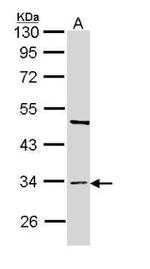 BST-1 Polyclonal Antibody