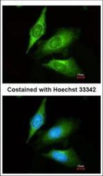 TMED4 Polyclonal Antibody