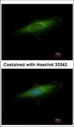 LAMP3 Polyclonal Antibody