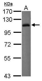 CD85j (ILT2) Polyclonal Antibody
