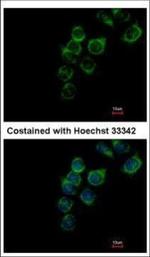 Transferrin Polyclonal Antibody