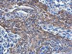 COL1A1 Antibody in Immunohistochemistry (Paraffin) (IHC (P))
