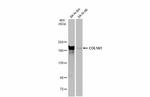 COL1A1 Antibody in Western Blot (WB)