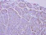 UCP1 Polyclonal Antibody