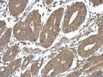 TICAM2 Polyclonal Antibody