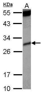 KIR2DS4 Antibody in Western Blot (WB)