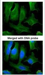 Fibronectin Antibody in Immunocytochemistry (ICC/IF)