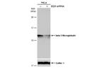 beta-2 Microglobulin Antibody in Western Blot (WB)