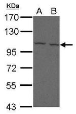 CD307e (FcRL5) Polyclonal Antibody