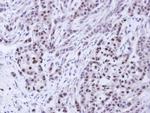 BAG1 Polyclonal Antibody