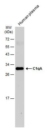 C1QA Antibody in Western Blot (WB)