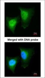 DAXX Polyclonal Antibody