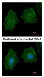 Filamin A alpha-2 Polyclonal Antibody