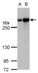 Filamin A alpha-2 Antibody in Western Blot (WB)