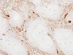 Ferritin Light Chain Polyclonal Antibody